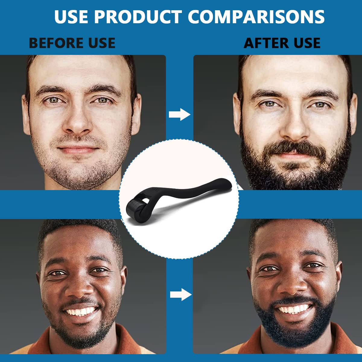 MAYCREATE Beard Roller for Men for Face Body Beard Hair Growth MAYCREATE Beard Roller for Men for Face Body Beard Hair Growth